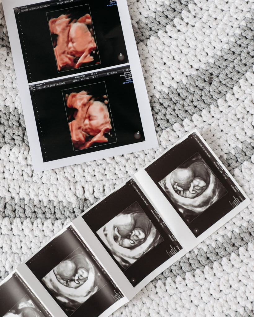 Postpartum Support: Single Session Support